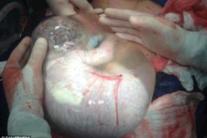 ŠEROVANA 8.000 PUTA: Beba koja još ne zna da je rođena!