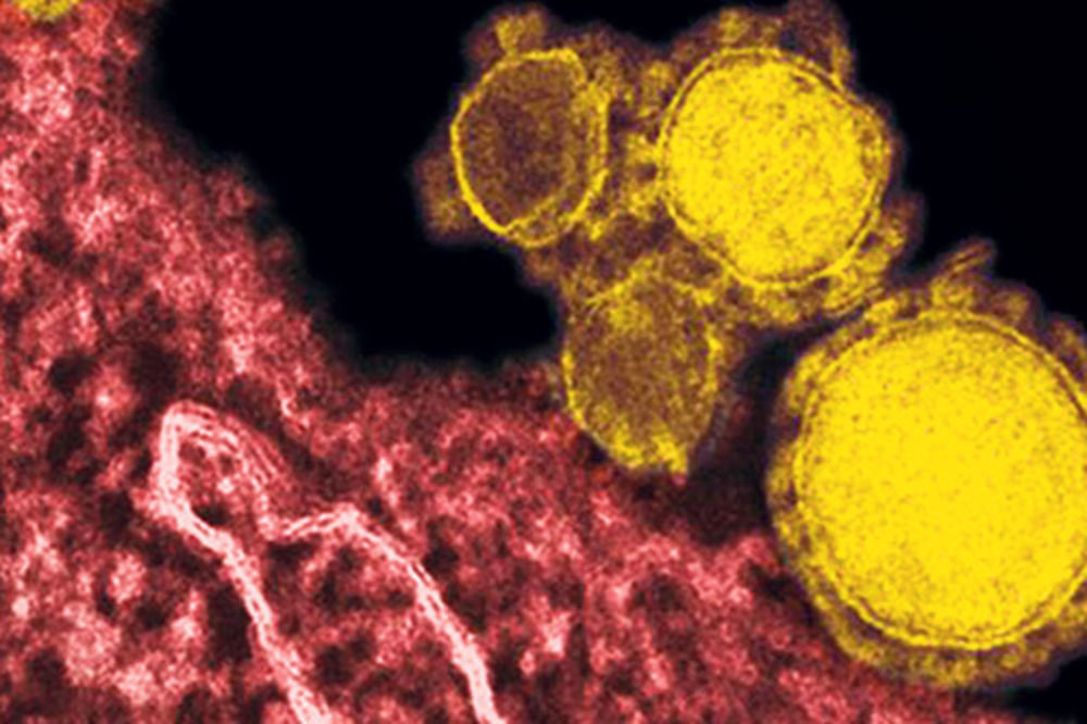 POŠAST: U Saudijskoj arabiji virus MERS ubio 107 ljudi