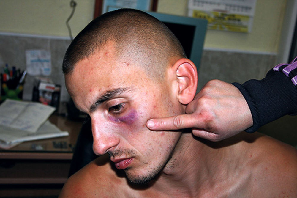 HAOS U ALEKSINCU: Policajci ga tukli, nije hteo da im pere kola za džabe!