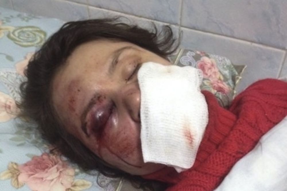 POGLEDAJTE: Ovako je pretučena ukrajinska novinarka!