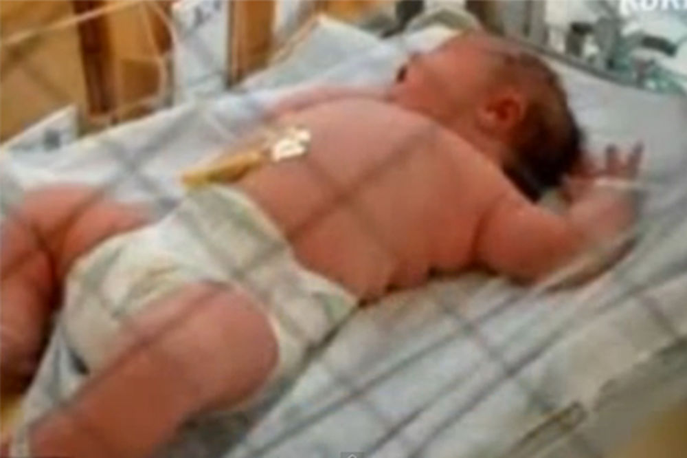 BEBA DŽIN: Dečak rođen sa 7,2 kilograma!
