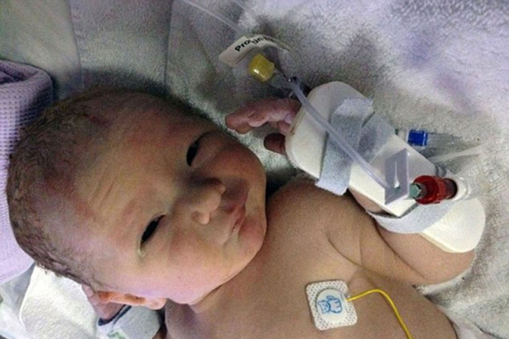 VELIKI HEROJ: Beba odbila da umre i preživela 5 teških operacija!