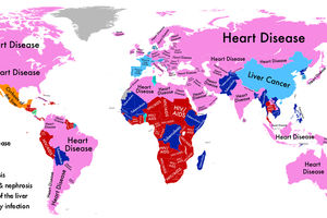 ZDRAVSTVENA MAPA SVETA: Saznajte koje bolesti vam prete, u zavisnosti od mesta gde živite!