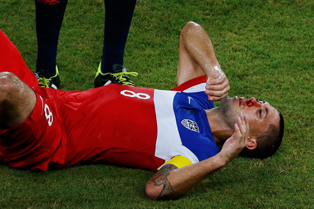 GUTAO KRV: Kapiten Amerike Klint Dempsi 60 minuta igrao sa slomljenim nosom
