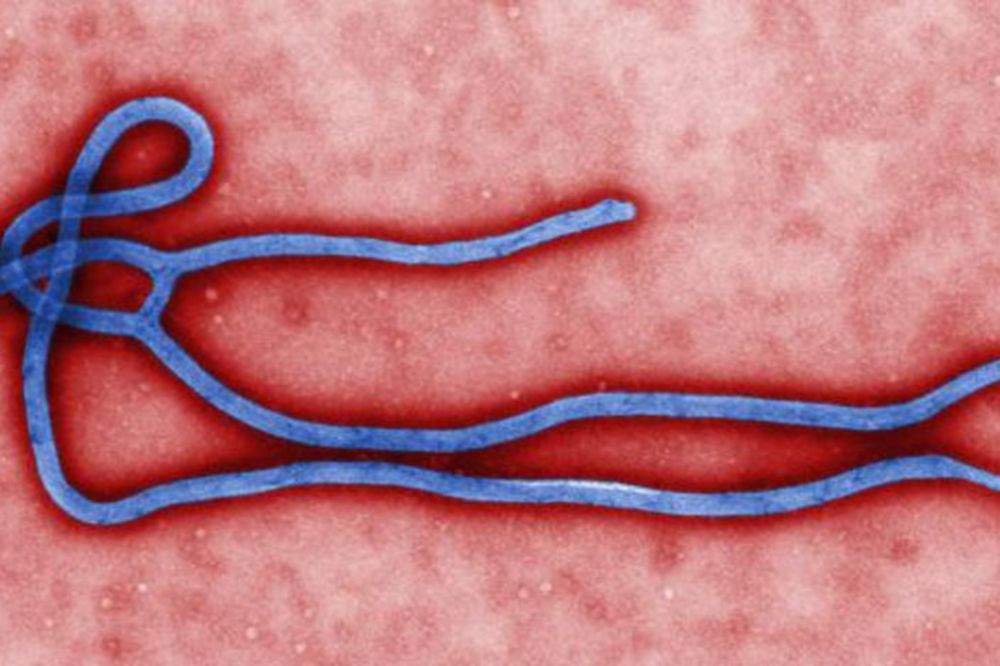 PANIKA U PRIŠTINI: Primljen pacijent sa simptomima ebole!