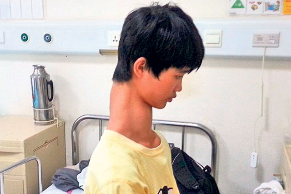 ČUDO: Kinez s najdužim vratom na svetu