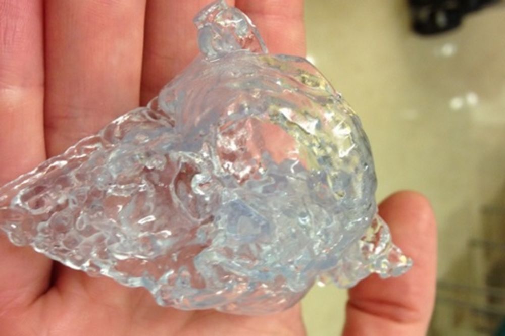 ČUDO NEVIĐENO: Srce iz 3D štampača spaslo bebi život!