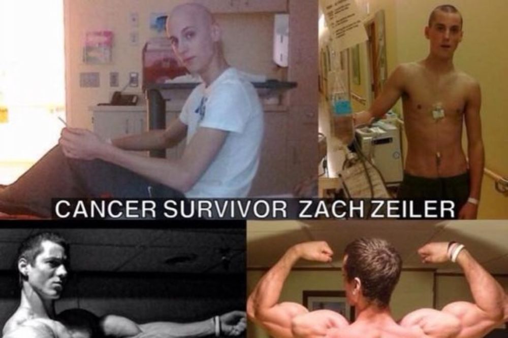 Upoznajte Zaka (20) koji je pobedio rak i postao bodibilder!