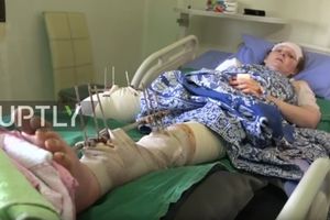 (VIDEO) MAJKA HEROJ: Štiteći decu od granate, Ruskinja izgubila nogu i ruku