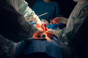 OPERACIJA SA POTPISOM: Hirurg stavljao svoje inicijale na organe pacijenata, ostao bez licence zbog nanošenja emotivnog bola