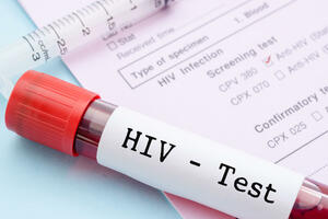 POČELA EVROPSKA NEDELJA TESTIRANJA NA HIV: Ove godine broj zaraženih je povećan, otkriveno 18 pozitivnih pacijenata