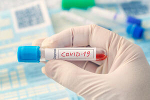 Australijski doktori: „Dugi kovid“ ne postoji, simptomi korona virusa ništa drugačiji od gripa